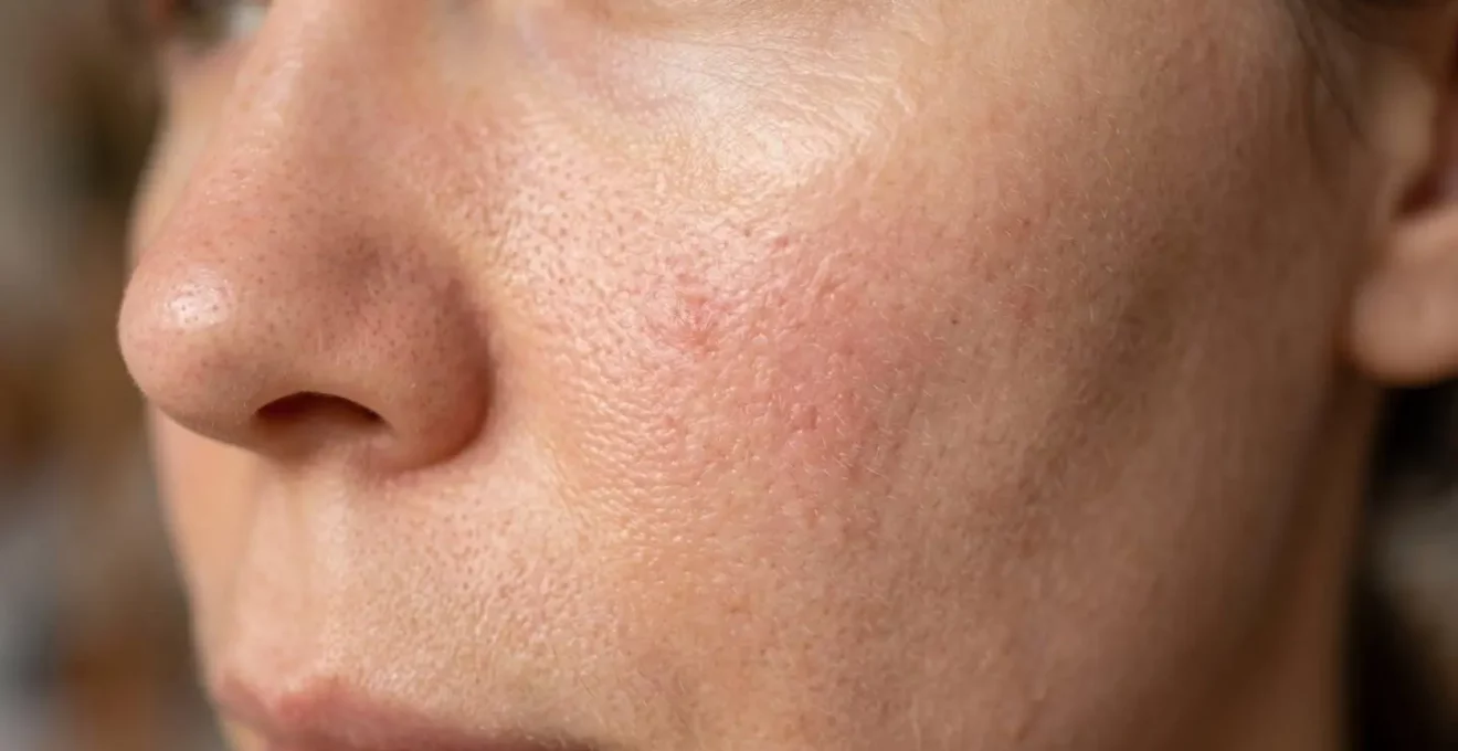 Gros plan sur une texture de peau présentant des signes de sensibilité avec éclairage doux et naturel